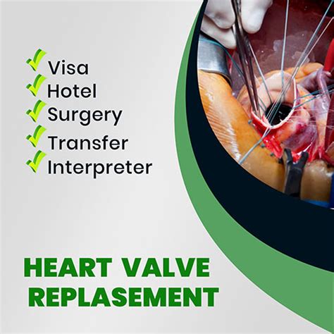 Open heart surgery in Iran - mahdadmedtour