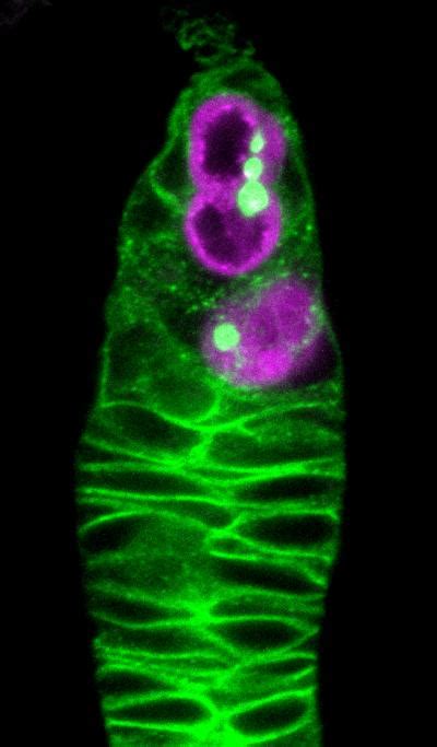 The Switch That Stops Sex Cells 4 Of 17 EurekAlert