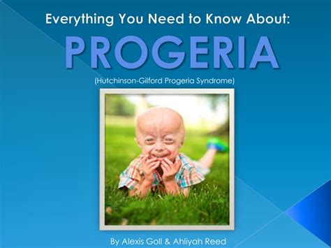 Progeria Research Foundation At Partnering For Cures Ppt