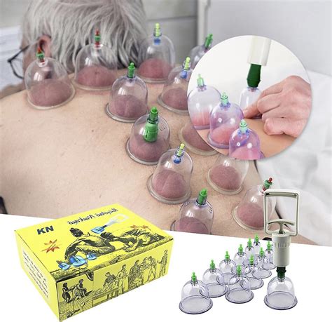 Cupping Set Professionele Chinese Acupoint Cupping Massage Set 12 Cups