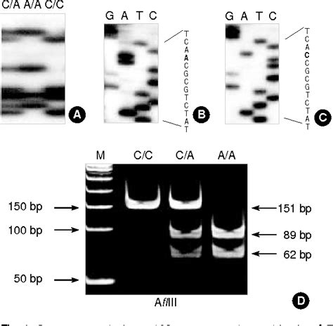 Figure From A Single Nucleotide Polymorphism In The E Cadherin Gene