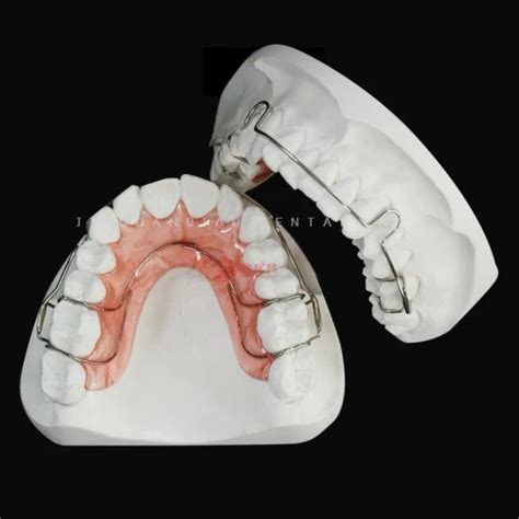 Improved Dental Orthodontic Hawley Retainer With Printed Resin Model