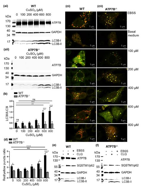 Course Of Copper Induced Autophagy In HepG2 WT And HepG2 ATP7B