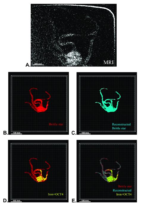 Three Dimensional 3d Reconstruction Of Brittle Star Tissue With Iron Download Scientific