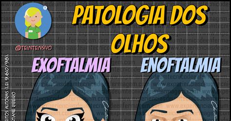 Patologia Dos Olhos Exoftalmia E Enoftalmia Enfermagem Ilustrada