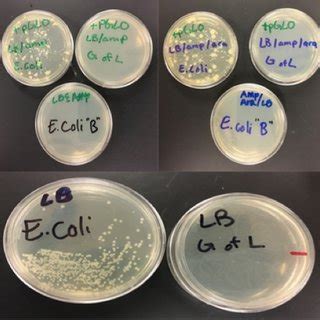 Growth of Newly Transformed Organisms Containing the pGLO Plasmid on ...