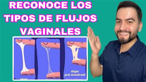 LOS TIPOS DE FLUJOS VAGINALES FLUJOS VAGINALES DR DAVID CAMPOS