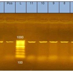 Agarose Gel Showing Polymerase Chain Reaction Pcr Amplified Product