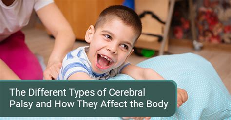 Ataxic Cerebral Palsy Children