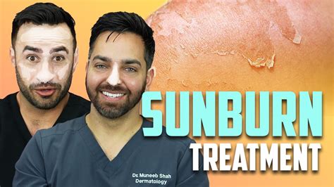 Sunburn How To Treat A Sunburn Like A Dermatologist Youtube