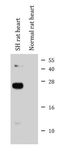 Anti Pln Phospholamban Phospho Thr17 抗体 Arg41951 Arigobio