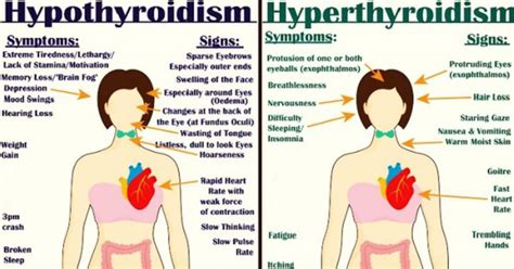 Everything You Need To Know About Every Thyroid Disorder Signs