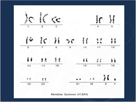 Practical Of Genetics Lab 4 5 Human Karyotype