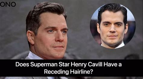 Does Superman star Henry Cavill Have a Receding Hairline? - Fans Dolls ...