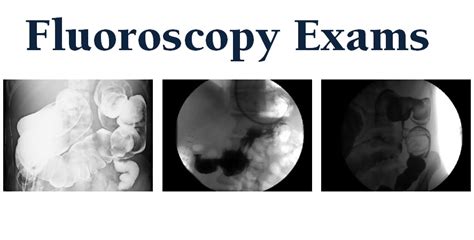 Fluoroscopy Imaging