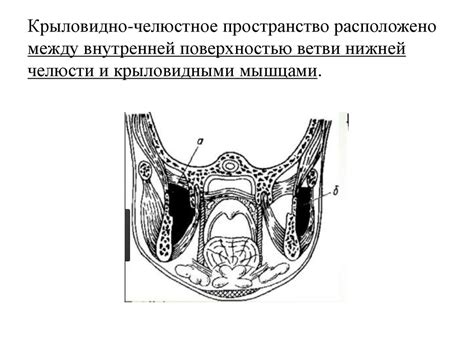 Абсцесс, флегмона крыловидно-челюстного пространства - презентация онлайн