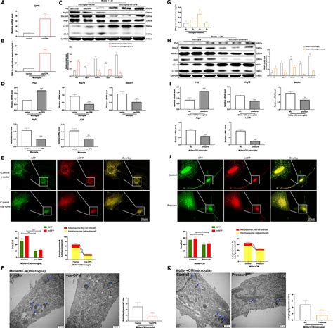 Molecular Signaling From Microglia Impacts Macroglia Autophagy And