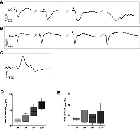 Cortical Spreading Depolarization Csds Within Clusters And