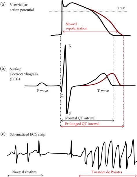 Schematic Representation Of Ventricular Action Potentials And Related