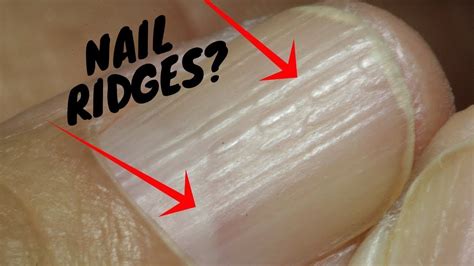 Do You Have These Vertical Ridges On Your Nails Palmistry Youtube