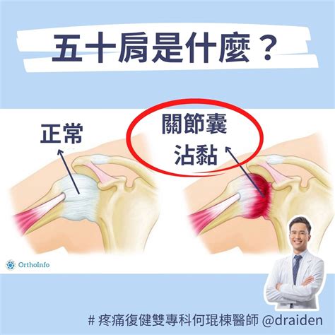 五十肩初期症狀是什麼？五十肩治療分析推薦！ 何琨棟醫師 Dr Aiden