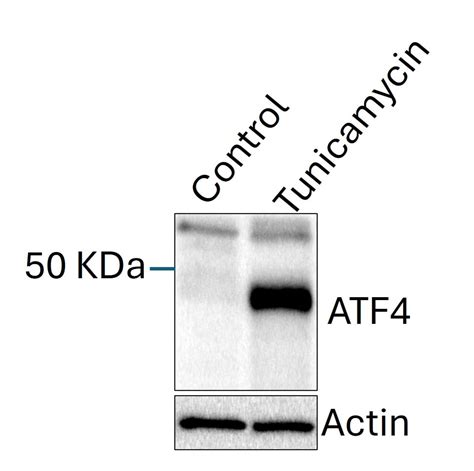 Atf4 Antibody 10835 1 Ap Proteintech