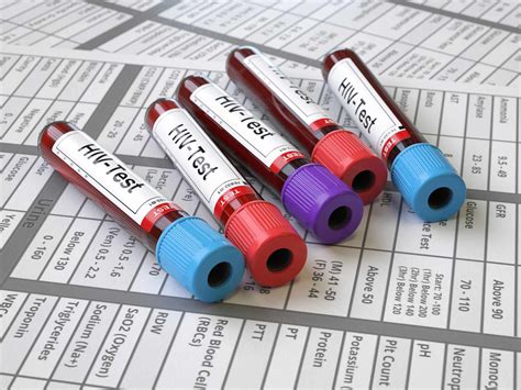 HIV Diagnosis: Testing and Getting Results