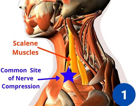 7 Causes Of Shoulder Pain And Tingling In The Fingers Facts And Physio