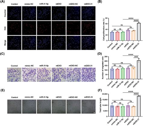 Mexo Promoted Endothelial Cell Proliferation Migration And