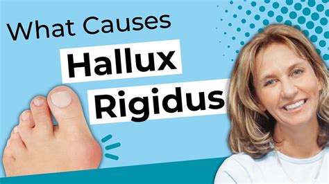 What Causes Hallux Rigidus Hallux Limitus Youtube