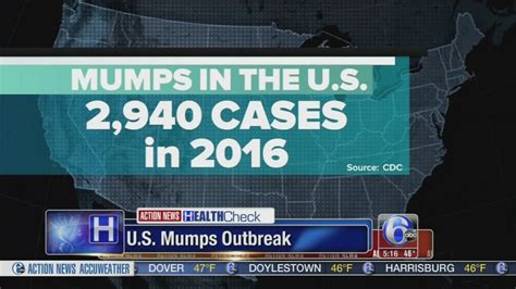 Growing outbreak of mumps in US - 6abc Philadelphia