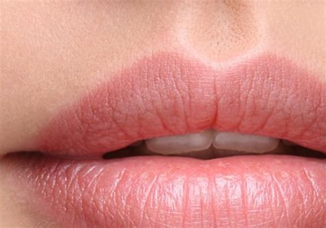 Are Lip Fillers Plastic Surgery A Comprehensive Guide