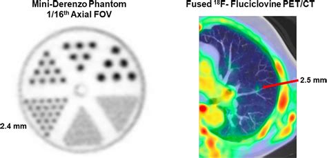 Performance Evaluation Of The Uexplorer Total Body Pet Ct Scanner Based