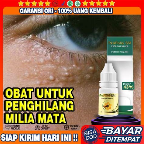 Jual Obat Milia Di Mata Obat Perontok Milia Obat Penghilang Milia