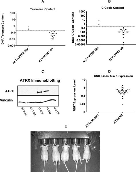 Identification Of Patient Derived Glioblastoma Stem Cell Gsc Lines