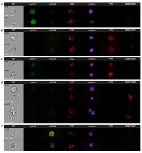 Cancers Free Full Text Detection And Characterization Of