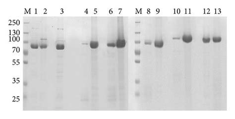 SDS PAGE Analysis Of Purified Protein From Soluble And Denatured