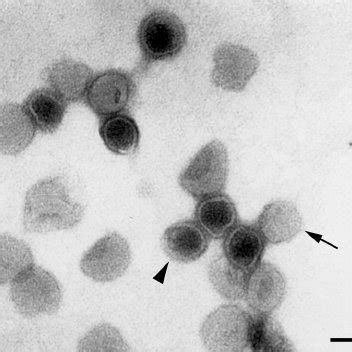 Thin Section Of A Naked RNA Virus Nodamura Virus Produced In The