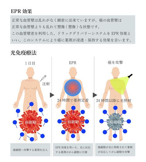 光免疫療法・がん治療専門院【ogc大阪がんクリニック】