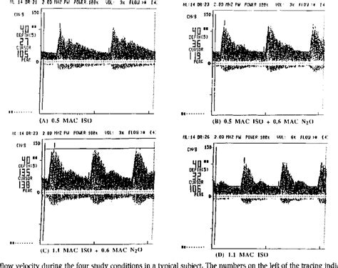 Figure From Nitrous Oxide Isoflurane Anesthesia Causes More Cerebral