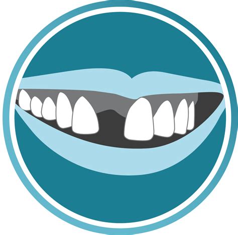 Clipart Smile Brace Clipart Smile Brace Transparent Free For Download