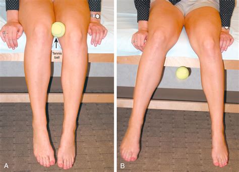 Adductor Tendon Injection For Adductor Tendonitis Clinical Tree