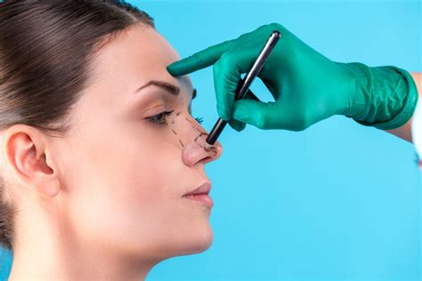 Rinoplastia Ultrasónica Qué Es Beneficios Y Resultados Blog Cirugía