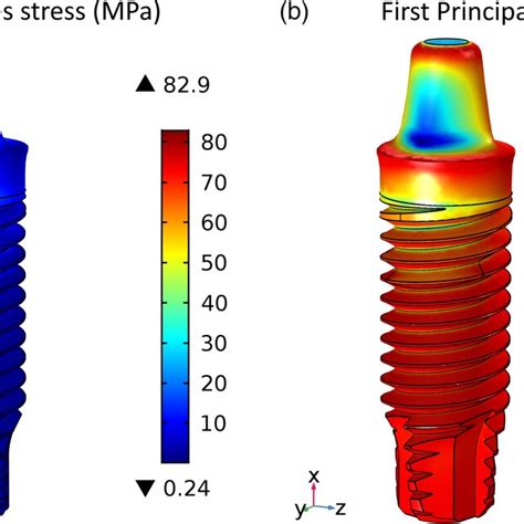 Von Mises Stress Mpa On The A One‐piece Titanium Implant And B Download Scientific