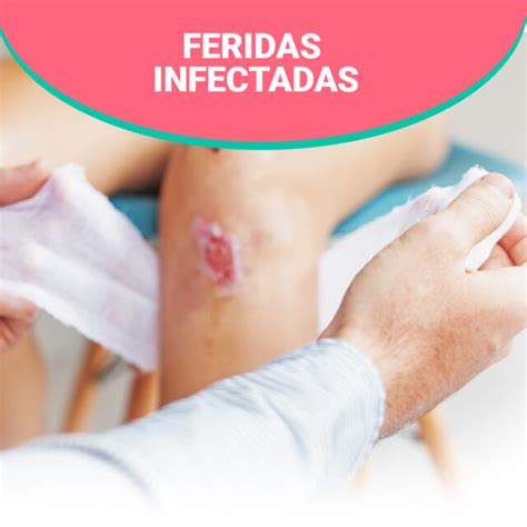 Machucado Infeccionado O Que Fazer - Como fazer limpeza de feridas infectadas de forma que facilite o tratamento