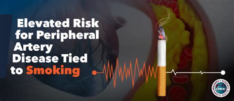 Elevated Risk For Peripheral Artery Disease Tied To Smoking