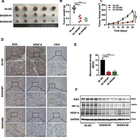 Knockdown Of SIX4 Inhibited Tumor Growth And Angiogenesis In Vivo A