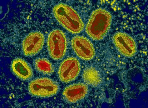 Drug To Treat Smallpox Approved By Fda A Move Against Bioterrorism