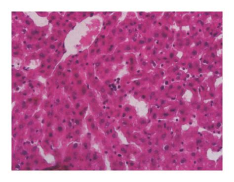 Photomicrographs Of Representative Sections Of Livers From The Control