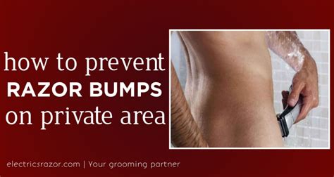 How To Prevent Razor Bumps On Private Area [ Full Guide ] Razor Bumps